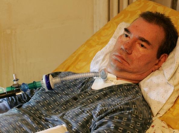 Papa Francisco excomunga Piergiorgio Welby e pede o fim da “Doce Morte”